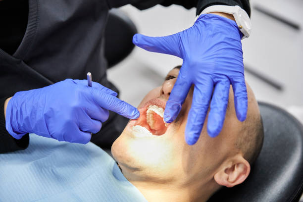 Best Emergency Treatment for Dental Infections or Abscesses in Maywood Park, OR